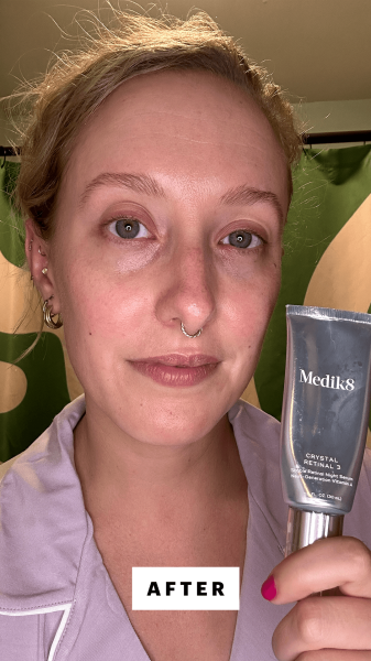 McGrath after applying the Medik8 Crystal Retinal